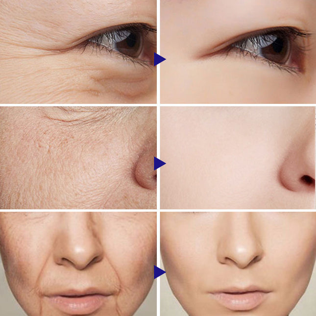 Vitamin C Serum Facial Serum Amazon - 𝓢𝓱𝓸𝓹𝓵𝓮𝓬𝔂