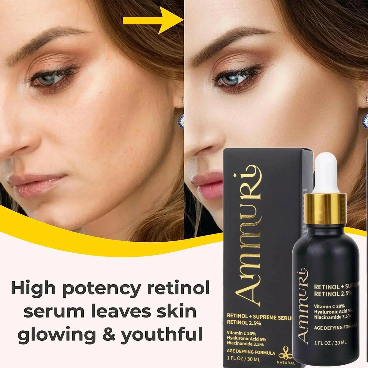 Retinol Supreme 2.5% Serum with Hyaluronic Acid & Niacinamide | Ammuri