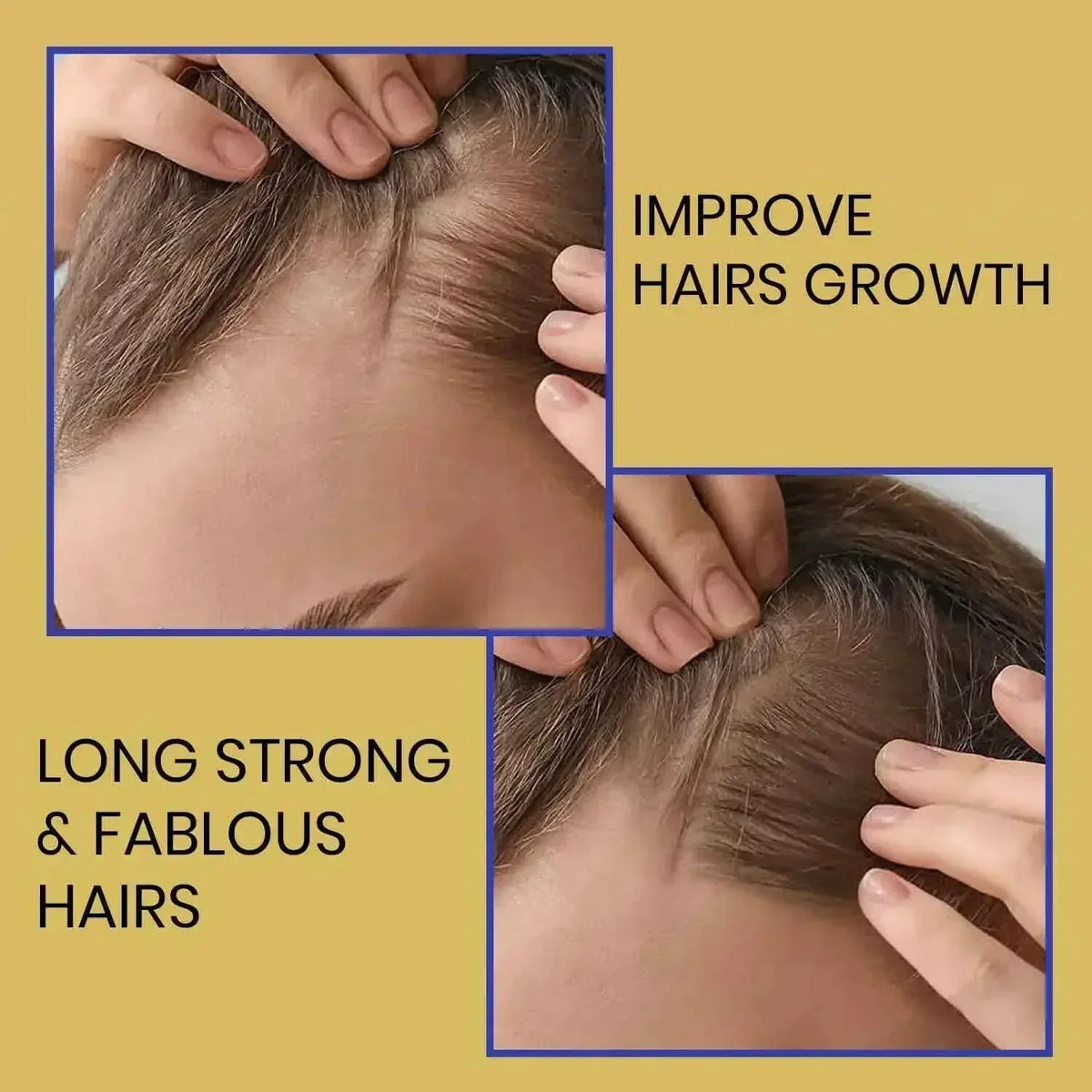 Biotin Shampoo & Hair Serum Set for Thinning-Looking Hair | Ammuri
