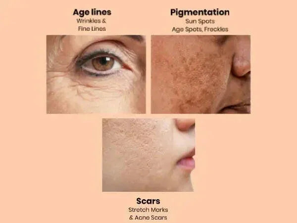 Retinol & Apple Stem Cell Face Cream for Fine Lines (50ml) | Ammuri