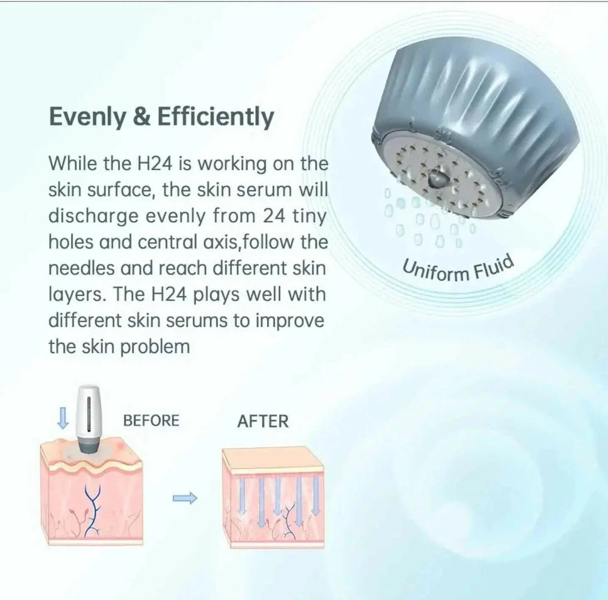 6-in-1 Microneedle Derma Roller Kit for Face, Body & Scalp | Ammuri