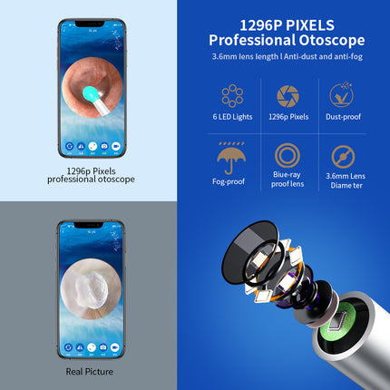 NE3 Ear Cleaner Otoscope Ear Wax Removal Tool With Camera LED Light Wireless Ear Endoscope Ear Cleaning Kit For I-phone - 𝓢𝓱𝓸𝓹𝓵𝓮𝓬𝔂